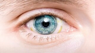 16_9_320x180_thumbnail_ratgeber_augengesundheit_bionisches_auge