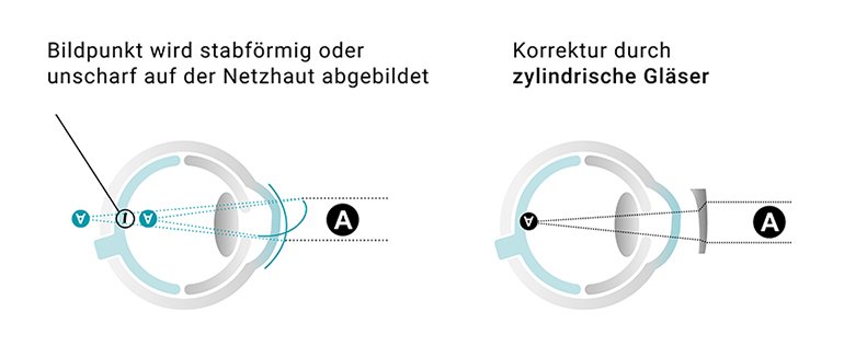 Was Bedeutet Zylinder Bei Brillen