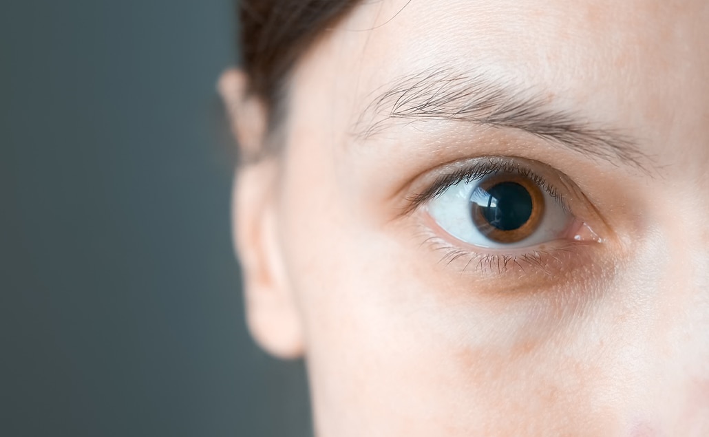Pupillen Erweitern Sich Wenn Man Verliebt Ist www.brille24.de