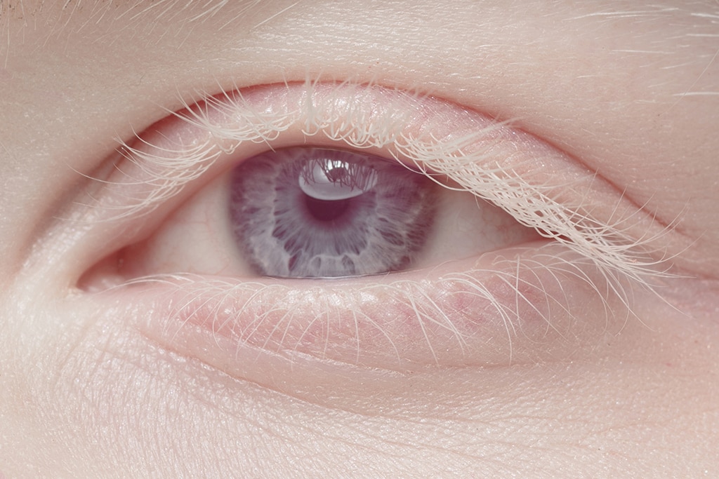Die Seltensten Augenfarben Brille24 DE die-seltensten-augenfarben-brille24-de